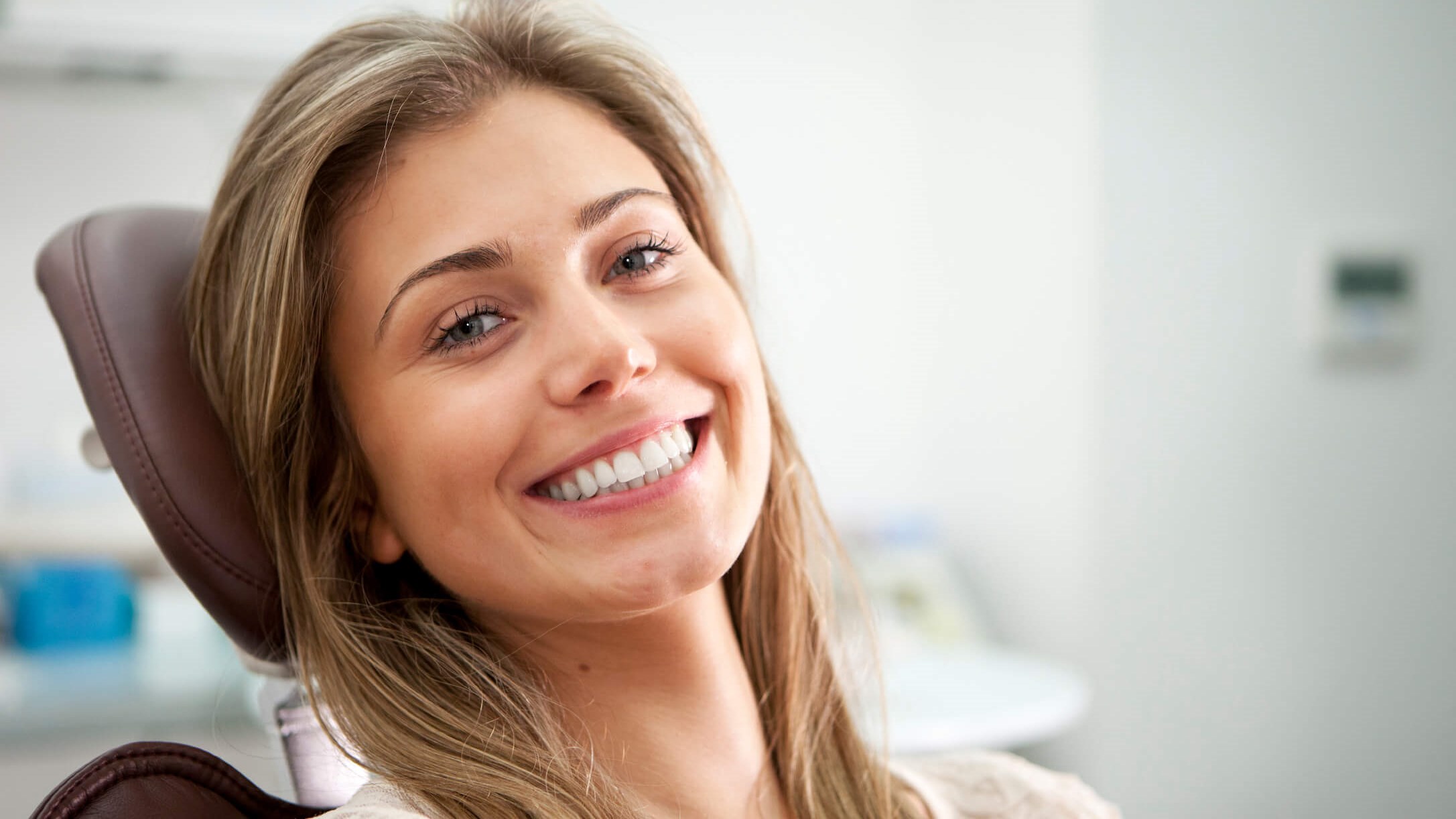 after veneers